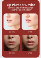 Silicone Lip Enhancer